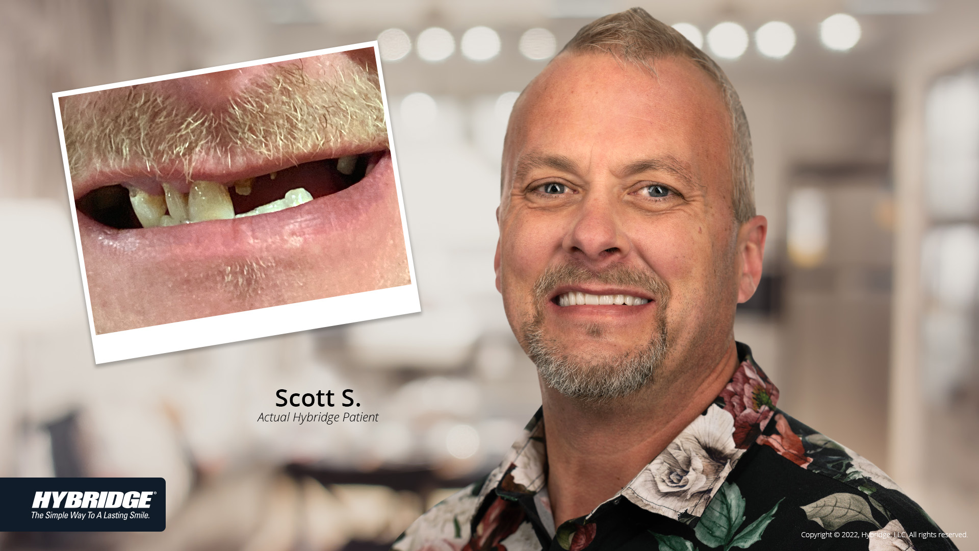 Before-After_Smile_Gallery_W-Bkgds_Scott-S_1920x1080