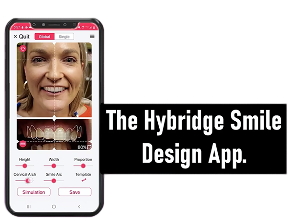 Smile Design App Sim